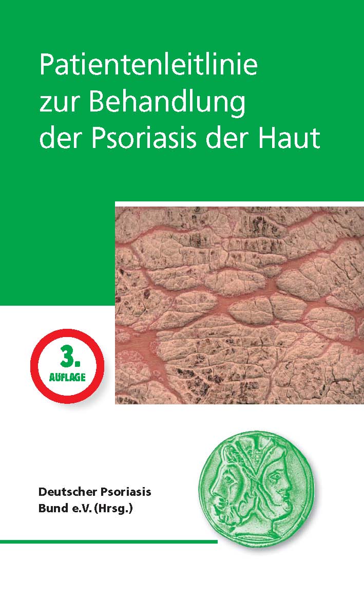 Wie асд2 bei der Schuppenflechte die Rezensionen zu trinken