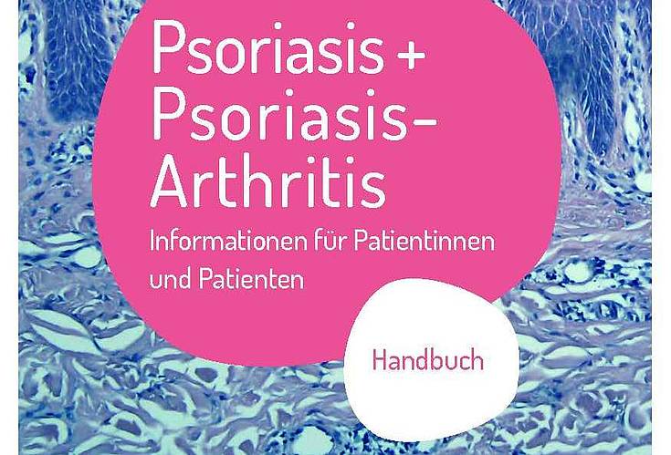 Handbuch Psoriasis + Psoriasis-Arthritis